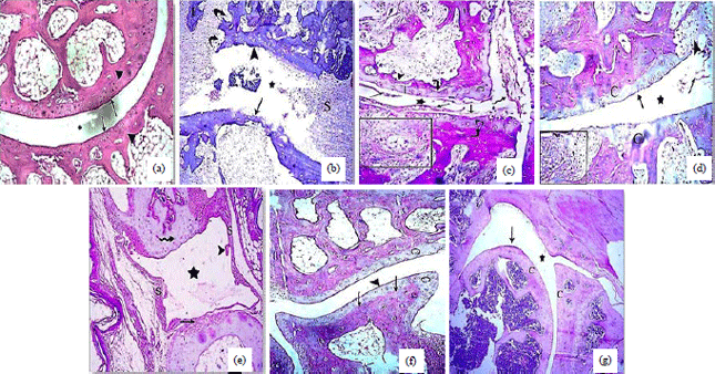 Image for - Stem Cell Mobilization with G-CSF and Cyclophosphamide Ameliorated Collagen-Induced Arthritis in Wistar Rats