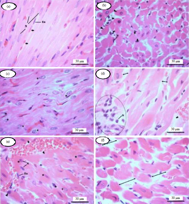 Image for - Chlorpheniramine Maleate Induced Cardiotoxicity, Hepatotoxicity and Antioxidant Gene Expression Changes in Male Wistar Rats