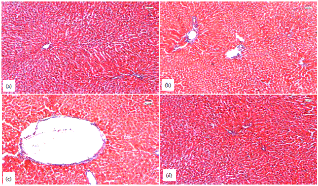 Image for - Curcumin Ameliorates Carbon Tetrachloride-induced Liver Injury in Rats Through Modulating Various Biological Activities