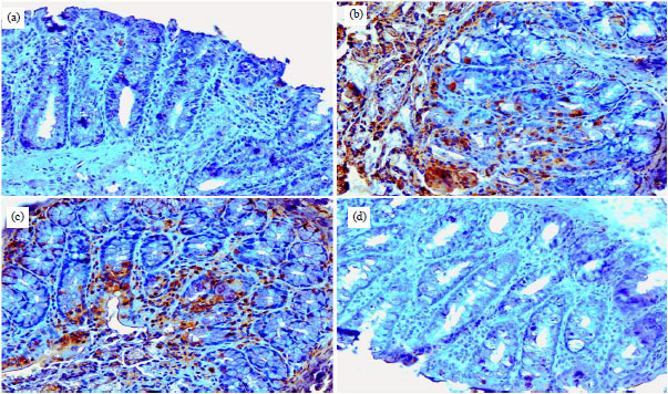 Image for - Brucine Prevents DMH Induced Colon Carcinogenesis in Wistar Rats