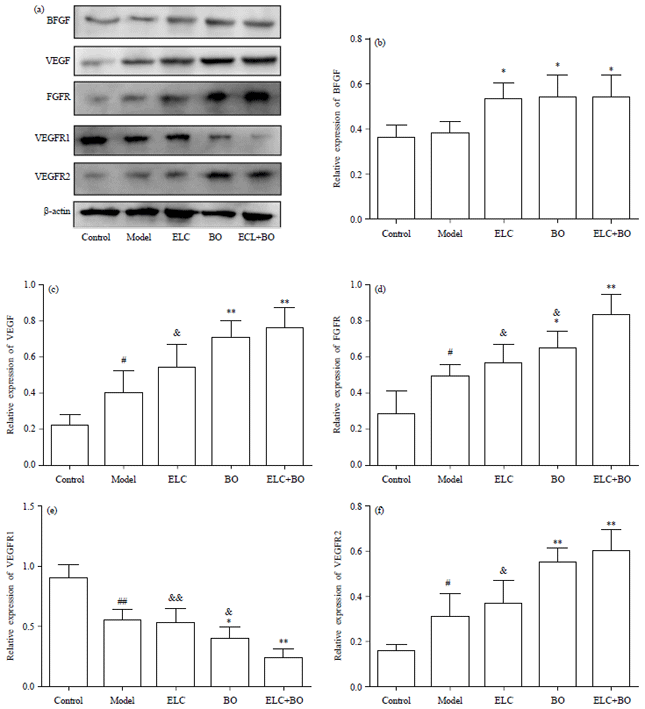 Image for - Synergic Effect of Ligusticum chuanxiong Hort Extract and Borneol in Protecting Brain Microvascular Endothelial Cells against Oxygen-Glucose Deprivation/Reperfusion Injury