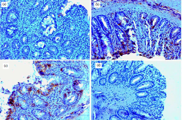 Image for - Brucine Prevents DMH Induced Colon Carcinogenesis in Wistar Rats