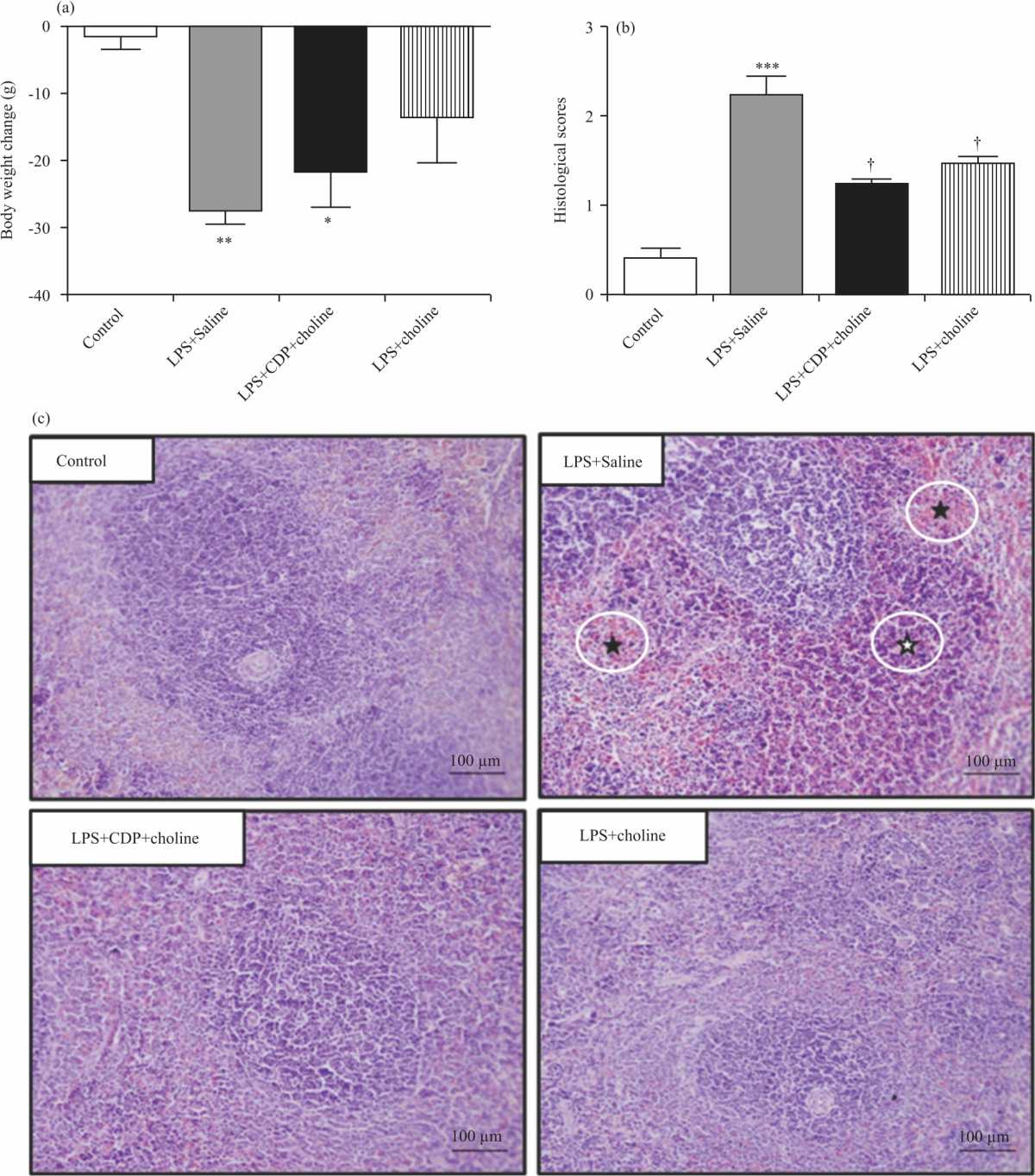 Image for - Effects of CDP-Choline and Choline on COX Pathway in LPS-Induced Inflammatory Response in Rats