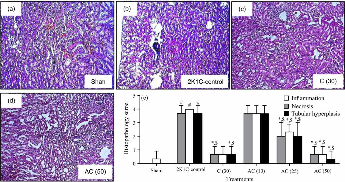 Image for - Acacetin Improves Renovascular Hypertension Via Inhibition of the Renin-Angiotensin Pathway in Experimental Rats