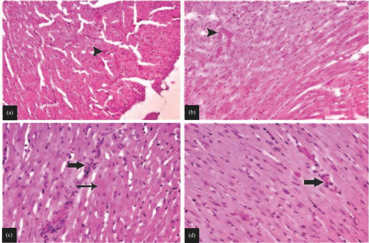 Image for - Effects of Adenosine Triphosphate on Vandetanib-Induced Heart Damage in Rats