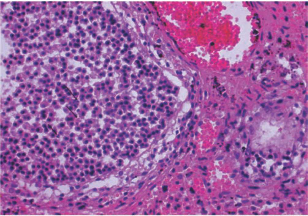 Image for - Biochemical and Histopathological Evaluation of Sunitinib Effect on Ovarian Injuries by Ischemia-Reperfusion in Rats