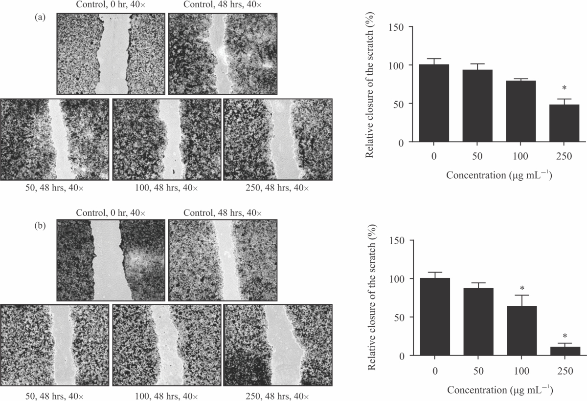 Image for - Growth Inhibition, Apoptosis Induction and Migratory Suppression by Careya arborea Leaf Extract in HeLa Cervical Cells