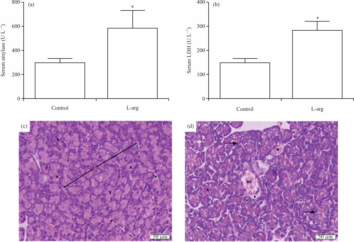 Image for - Metformin Ameliorates Infiltration of Inflammatory Cells and Pancreatic Injury Biomarkers Induced by L-Arginine