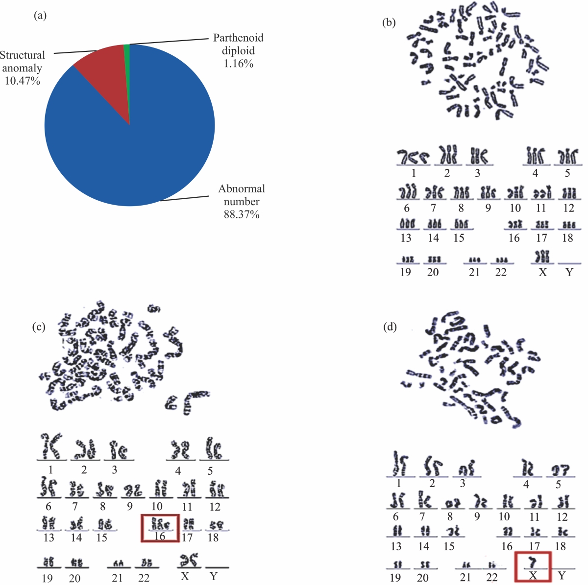 Image for - Application of High-Throughput Ligation-Dependent Probe Amplification (HLPA) Detection in Karyotype Analysis of Spontaneous Abortion Pregnancy Tissues