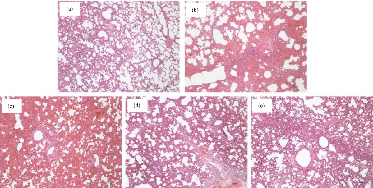 Image for - Gelsolin Attenuates Lipopolysaccharide-Induced Acute Lung Injury in Rats by Modulating TLR4/Myd88/NF-κB Signaling Pathway