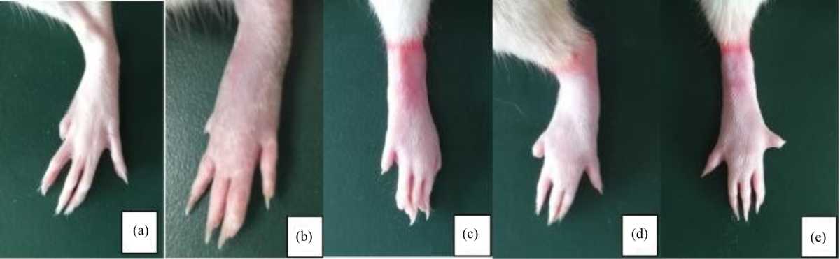 Image for - The Anti-Arthritis Effect of Cinnamaldehyde on Adjuvant Arthritis Rats