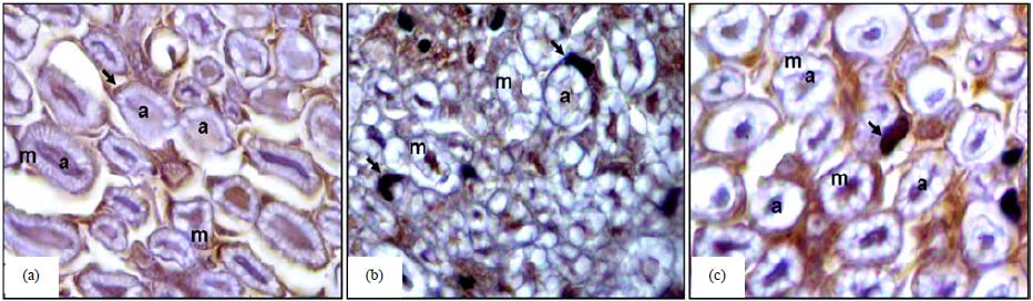 Image for - Protective Effect of Polyethylene Glycol (PEG) 3350 on a Cisplatin-Induced Rat Model of Neuropathy