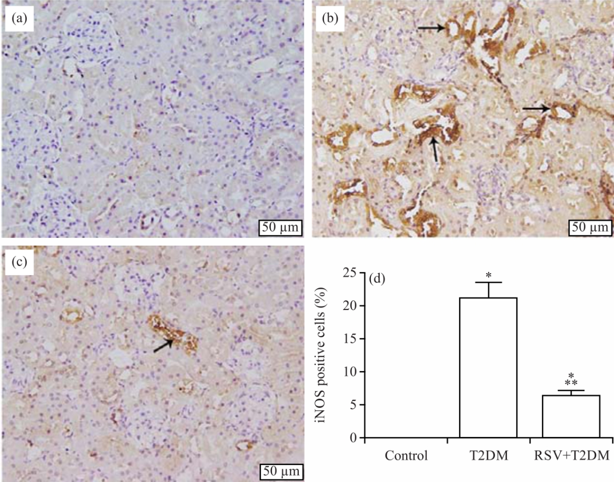 Image for - Resveratrol Ameliorates Kidney Injury and Fibrosis Secondary to Diabetes in Association with Inflammation and Nitrosative Stress Inhibition in Rats