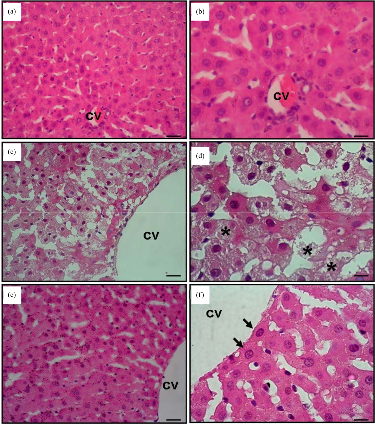 Image for - Ameliorating Effect of Propofol on Cisplatin-Induced Liver and Kidney Damage in Rats