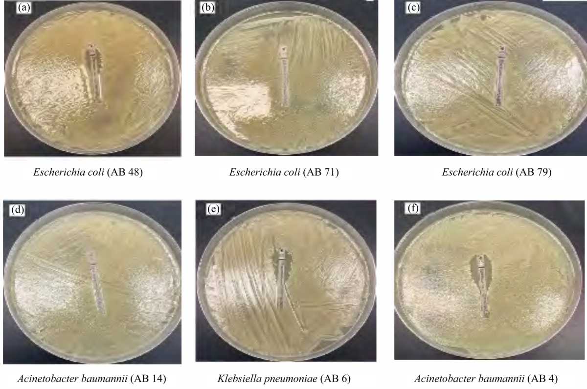 Image for - Investigation of Colistin and Polymyxin B on Clinical Extreme Resistant Enterobacteriaceae Isolates for Surveillance Purposes