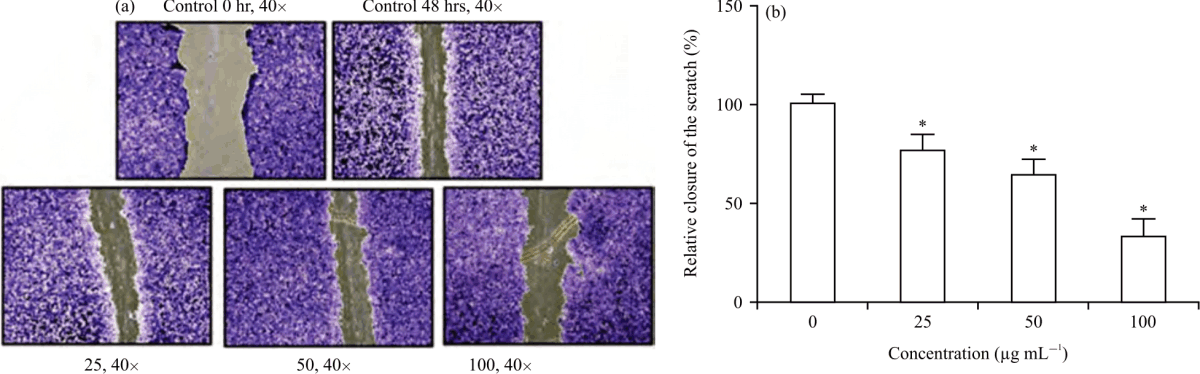 Image for - Anticancer Activities of Phlogacanthus pulcherrimus Leaf Extracts on HeLa Cancer Cells: In vitro study