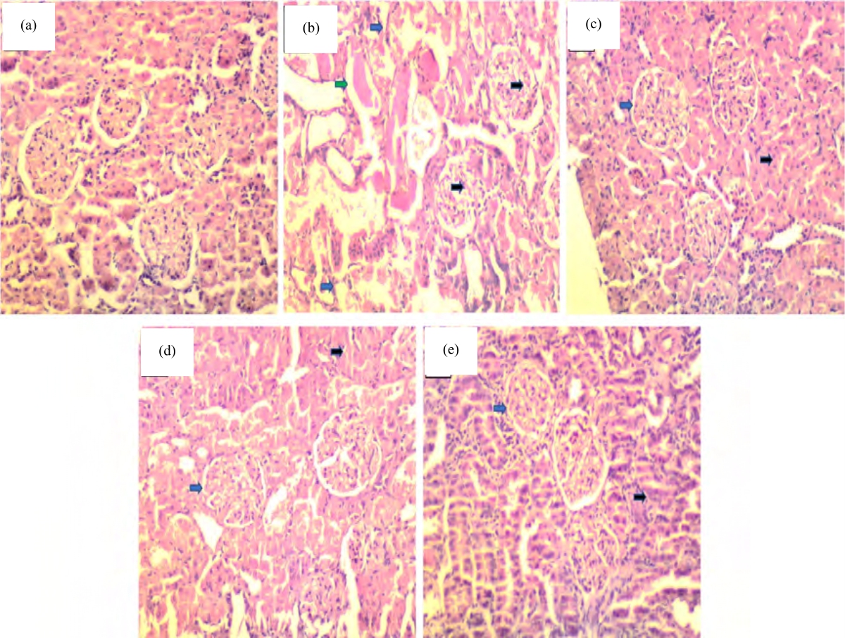 Image for - Renoprotective and in silico Modeling Studies of Febuxostat in Gentamicin Induced Nephrotoxic Rats