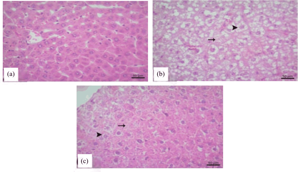 Image for - Effects of Mirtazapine on Liver Ischemia-Reperfusion Injury in Rats