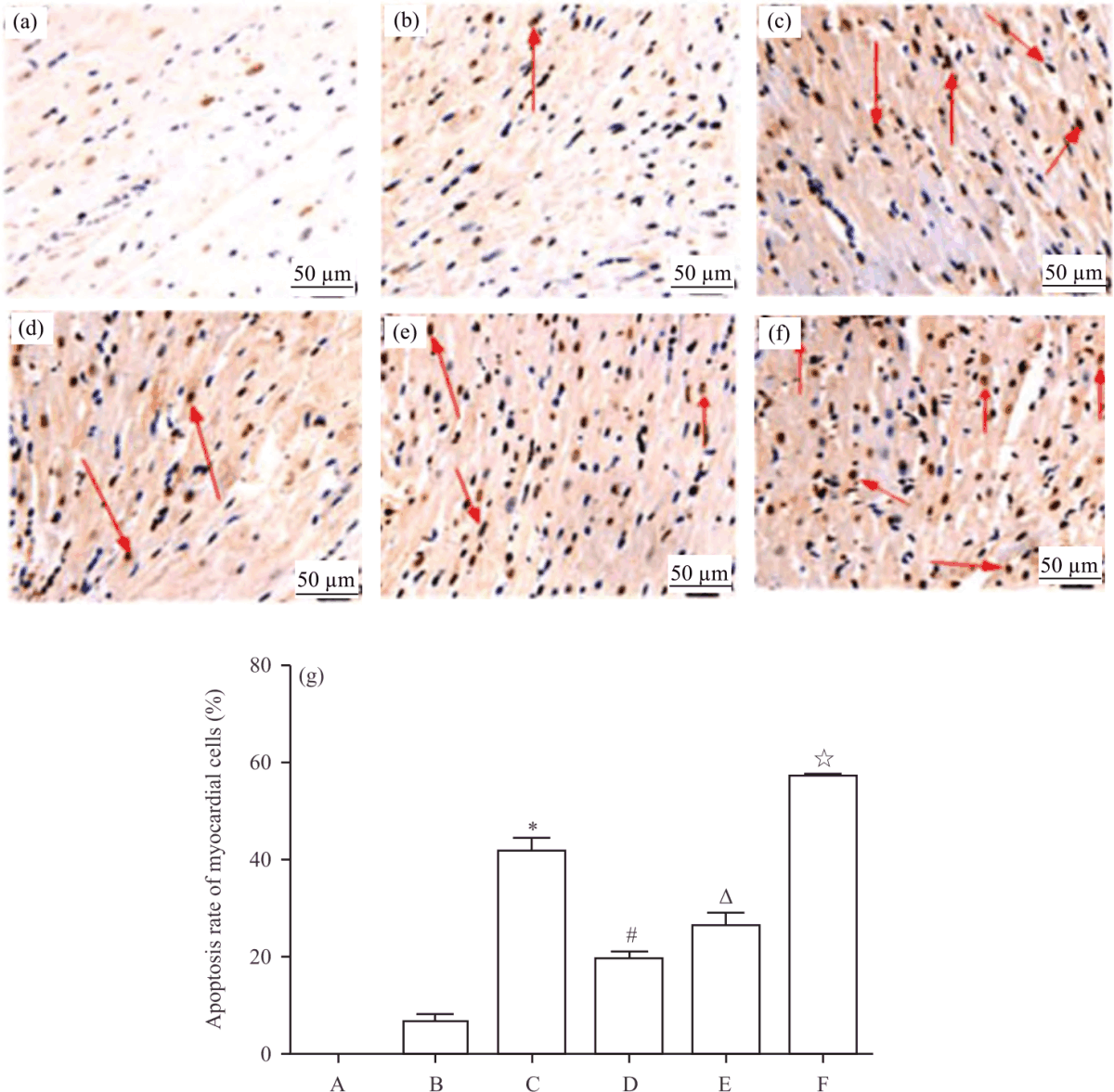 Image for - Role of Nrf2/ARE Pathway in Morphine Preconditioning to Alleviate Rat Myocardial Ischemia-Reperfusion Injury
