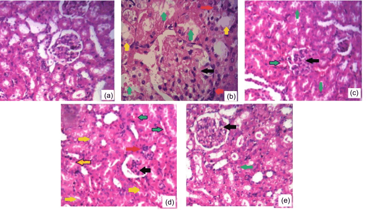 Image for - Thymoquinone and Oleuropein Combination Ameliorates Renal Ischemia-Reperfusion Injury by Attenuating Oxidative Stress in Rats