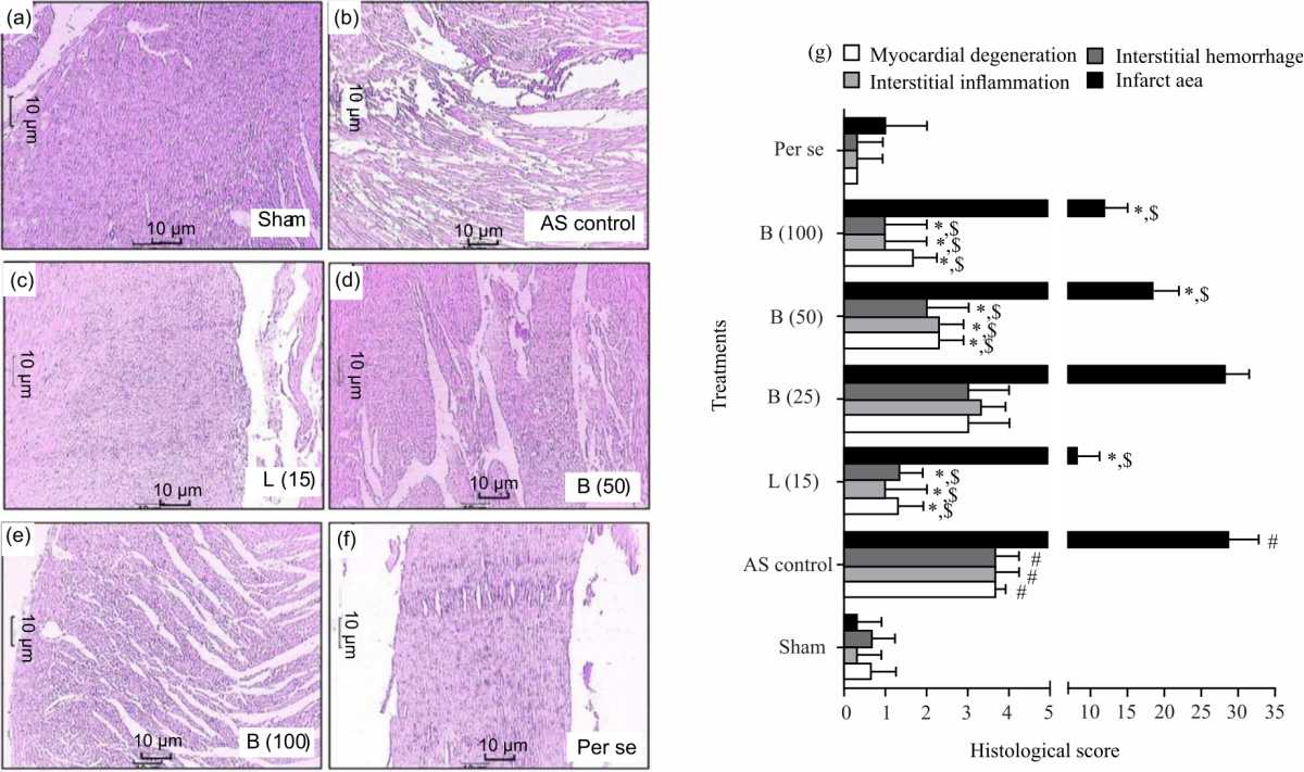 Image for - Bisacurone Ameliorated Pressure Overload-Induced Cardiac Hypertrophy in Experimental Rats Through Inhibition of Oxidative Stress and Bax/Caspase-3 Pathway