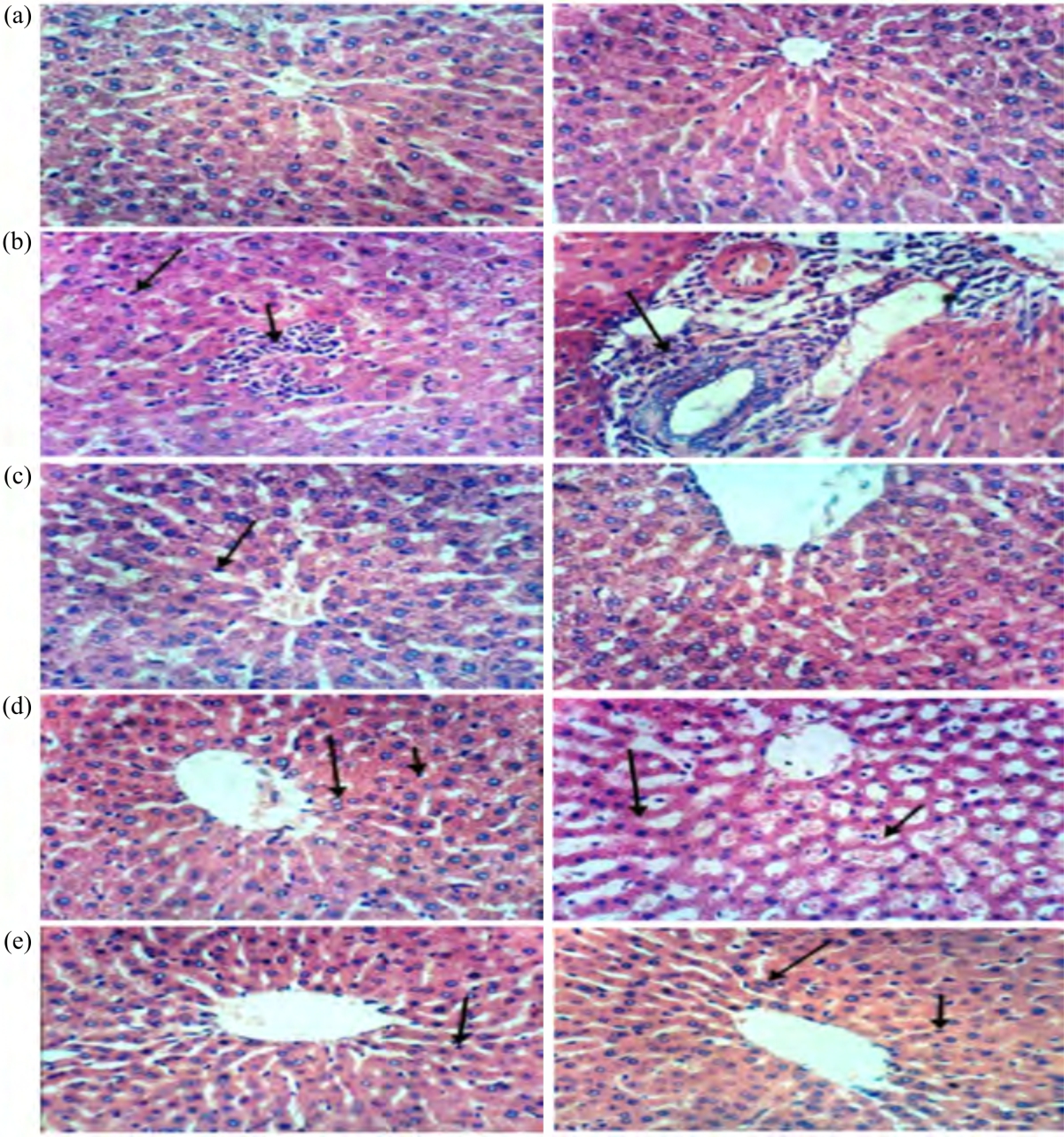 Image for - Hepatoprotective Effect of Spirulina platensis on Liver Functions of Diabetic Rats via TNF-α and IL-6 Pathway