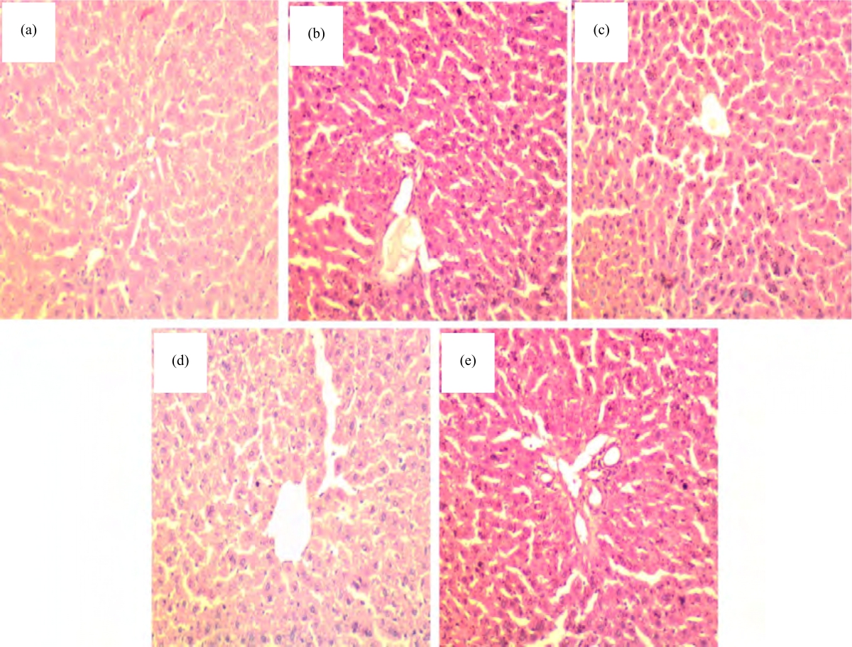 Image for - Renoprotective and in silico Modeling Studies of Febuxostat in Gentamicin Induced Nephrotoxic Rats