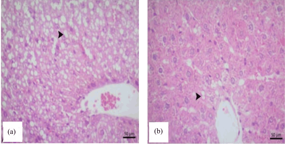 Image for - Effects of Mirtazapine on Liver Ischemia-Reperfusion Injury in Rats