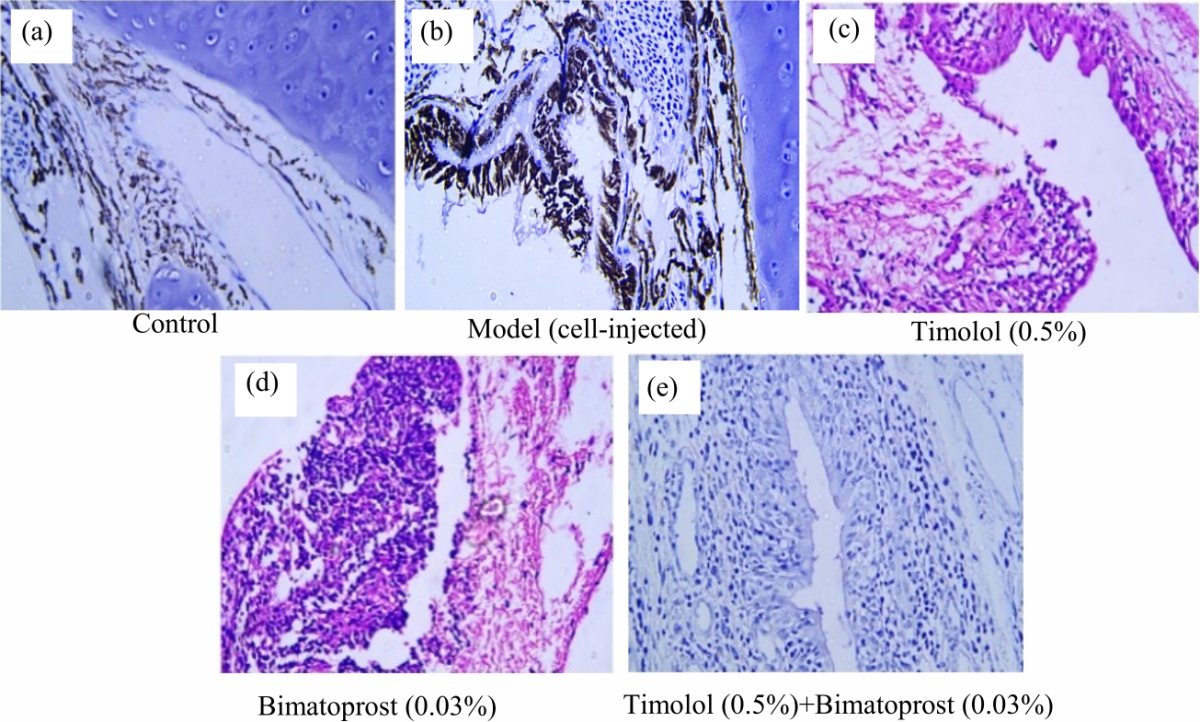 Image for - Anti-Glaucoma Effects of Timolol and Bimatoprost in Novel Ocular Hypertension Model in Rats