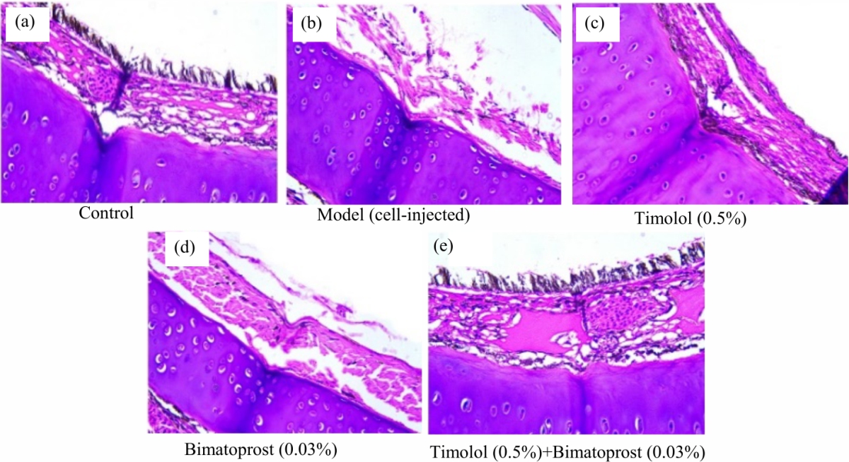 Image for - Anti-Glaucoma Effects of Timolol and Bimatoprost in Novel Ocular Hypertension Model in Rats