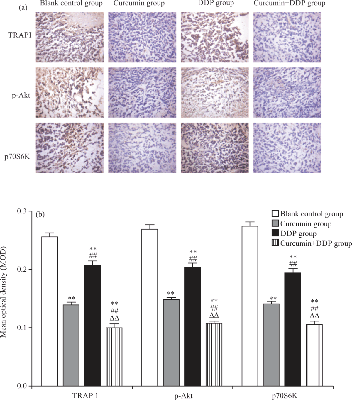 Image for - Curcumin Improving Drug Resistance of MDA-MB-231/DDP Tumor Treatment by Enhancing Autophagy