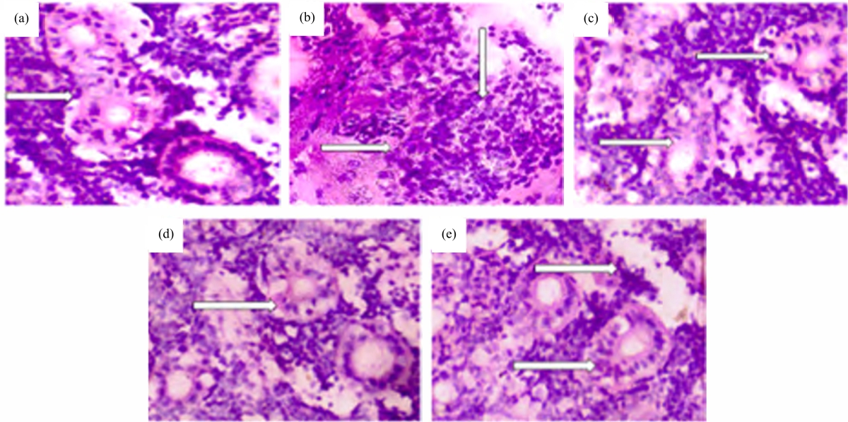 Image for - Crataegus oxyacantha Extract Mitigates Diabetic Nephropathy via Oxidative Stress Regulation in Streptozotocin-Induced Zebrafish Model