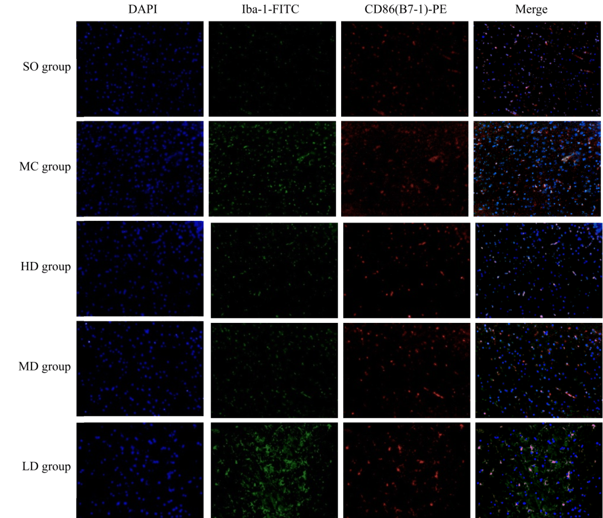 Image for - Improving Cognitive Function Through Inhibiting the Activation of Microglia by Jia Wei Kai Xin San on Alzheimer's Disease Rats
