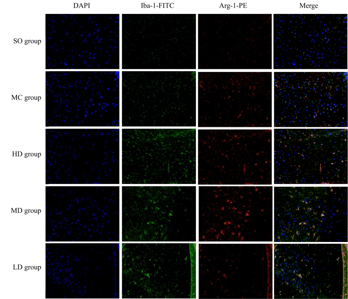 Image for - Improving Cognitive Function Through Inhibiting the Activation of Microglia by Jia Wei Kai Xin San on Alzheimer's Disease Rats