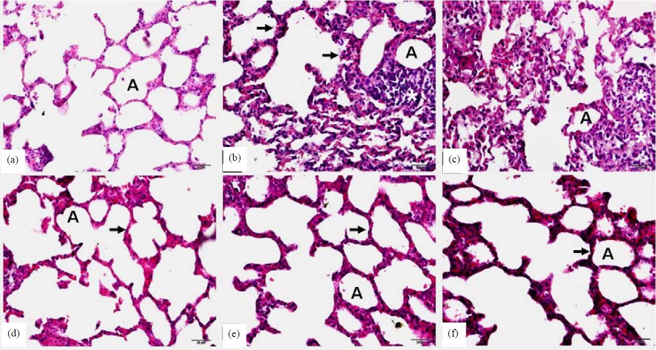 Exploring Beta Blockers’ Efficacy in Sepsis-Induced Acute Lung Injury ...