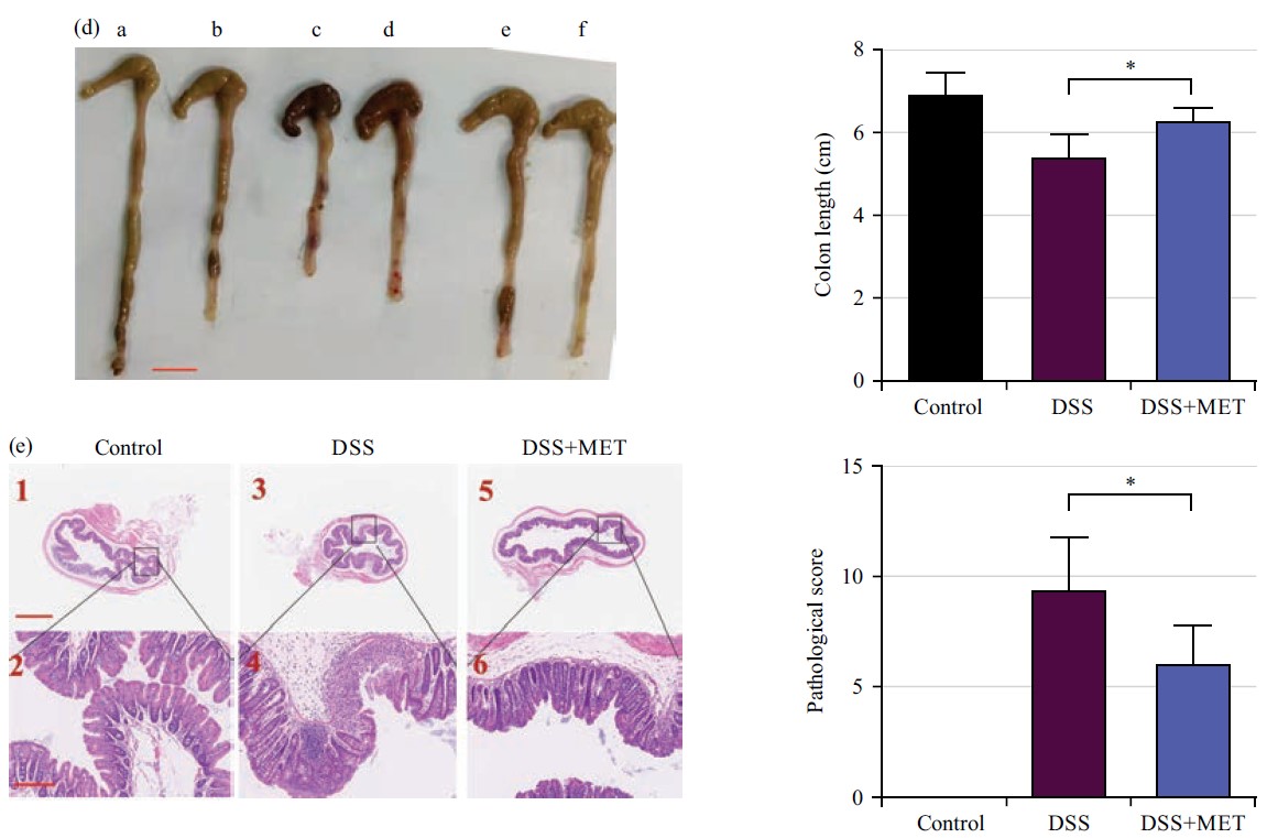 Metformin Alleviates Dextran Sulfate Sodium-Induced Colitis In A Mouse ...