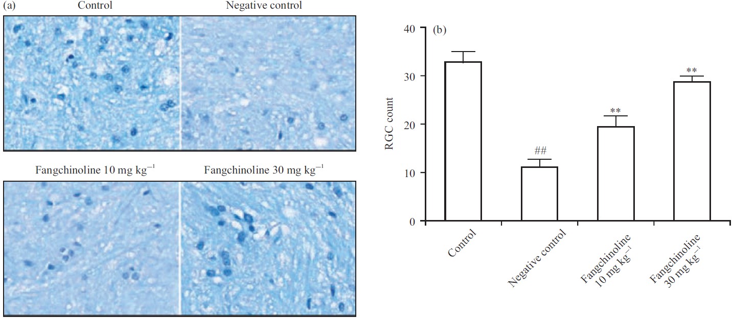Image for - Protective Effect of Fangchinoline Against Glaucoma and Neuroinflammation in Unilateral Ocular Hypertension in Mice