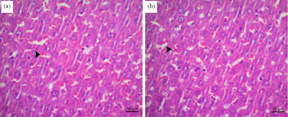Image for - Effect of Thiamine Pyrophosphate upon Possible Metamizole-Induced Liver Injury in Rats