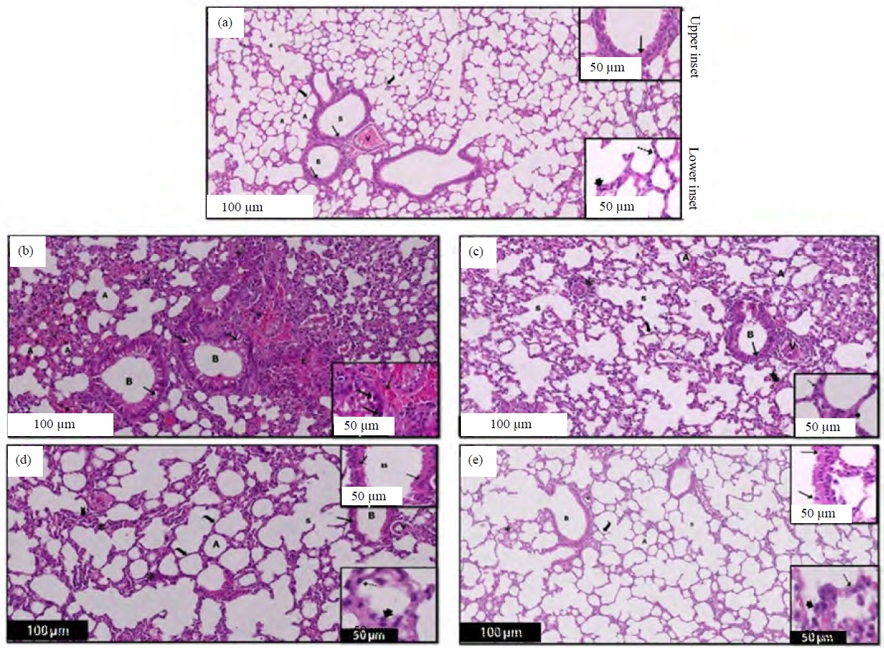 Image for - Potential Protective Effect of Agmatine on Bleomycin-Induced Pulmonary Fibrosis in Male Albino Rats