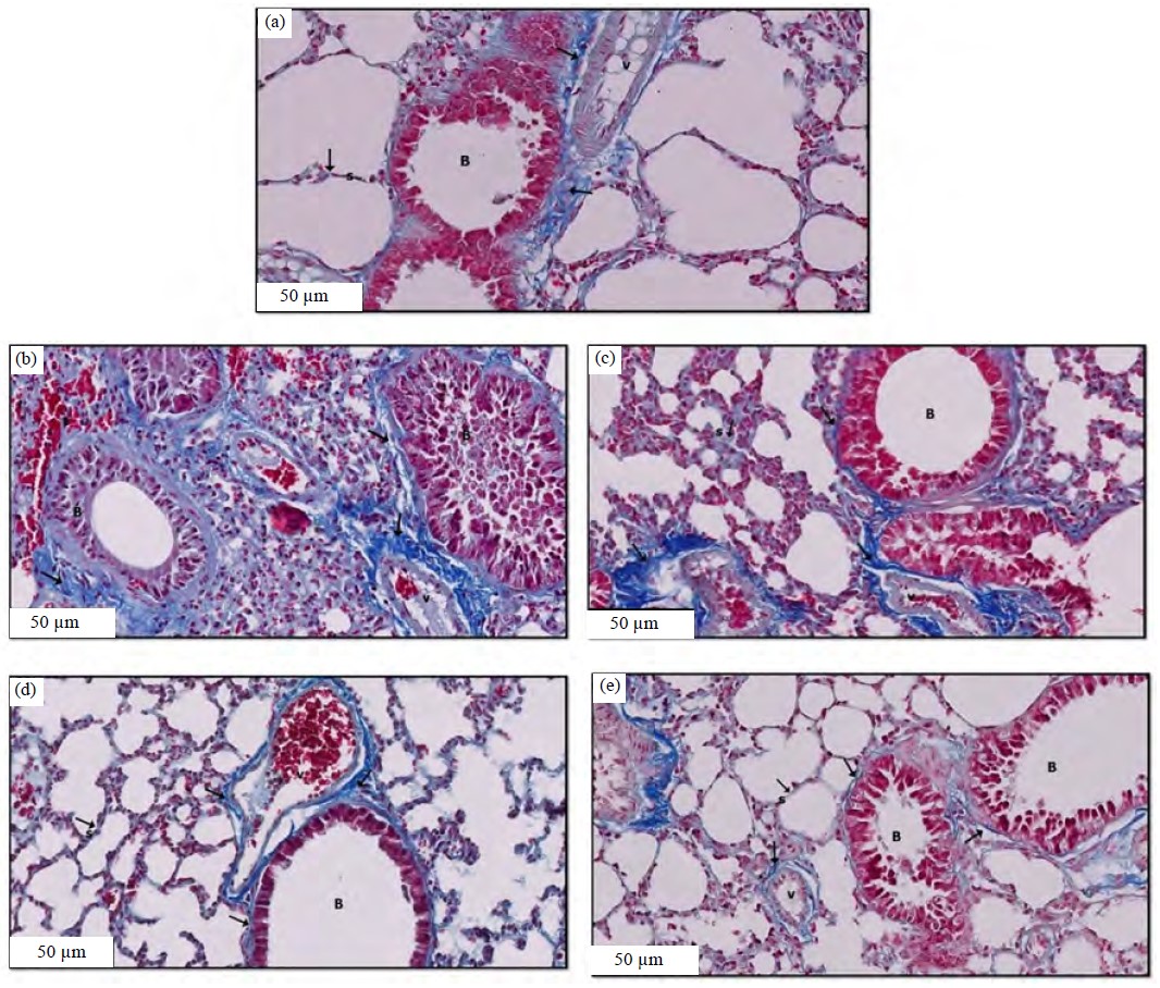 Image for - Potential Protective Effect of Agmatine on Bleomycin-Induced Pulmonary Fibrosis in Male Albino Rats