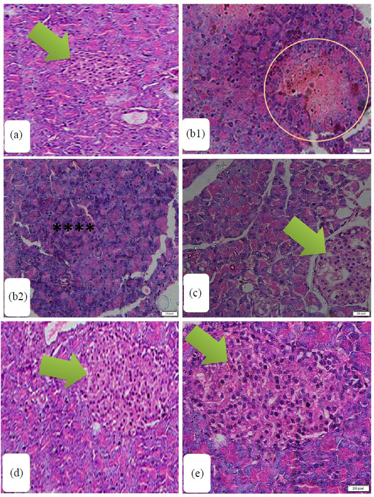 Orlistat and Metformin Effectively Reduce Pancreatic Dysfunction