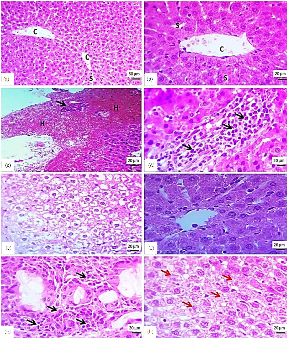 Image for - Effect of Ellagic Acid on Tamoxifen-Induced Hepatotoxicity in Rats