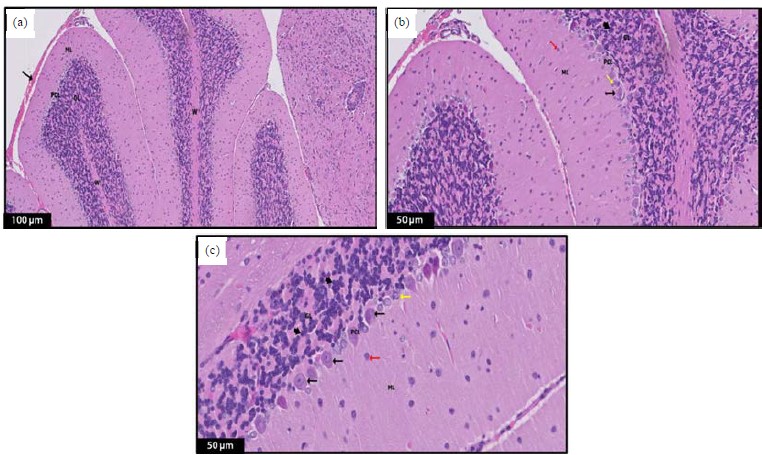 Protective Effects of Luteolin on a Rat Model of Autism: An Analysis of ...