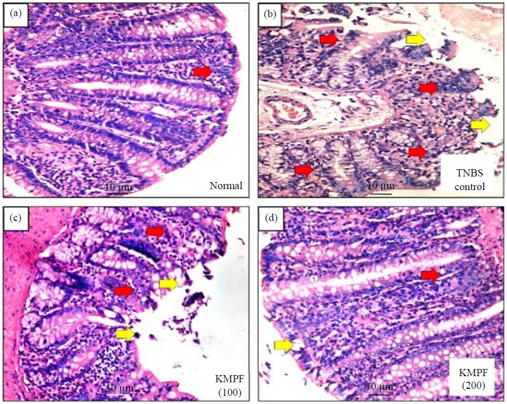 Image for - Ameliorative Potential of Kaempferol in TNBS-Induced Colitis in Experimental Rats: A Role of Activation of PPARγ Pathway