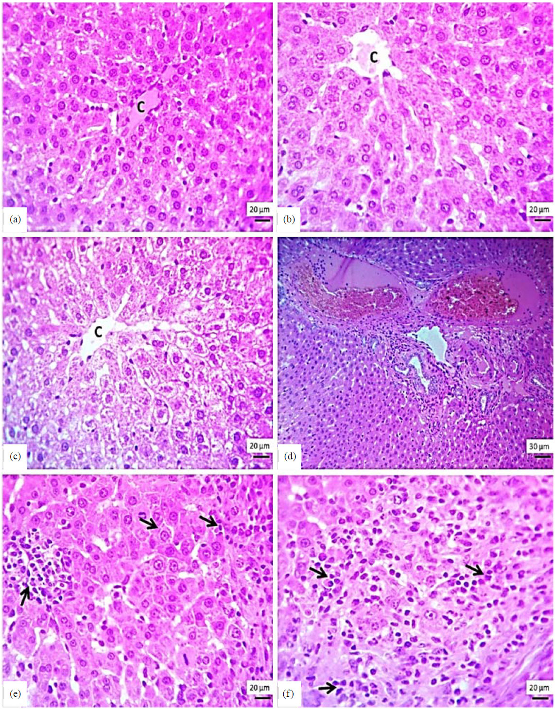 Image for - Effect of Ellagic Acid on Tamoxifen-Induced Hepatotoxicity in Rats