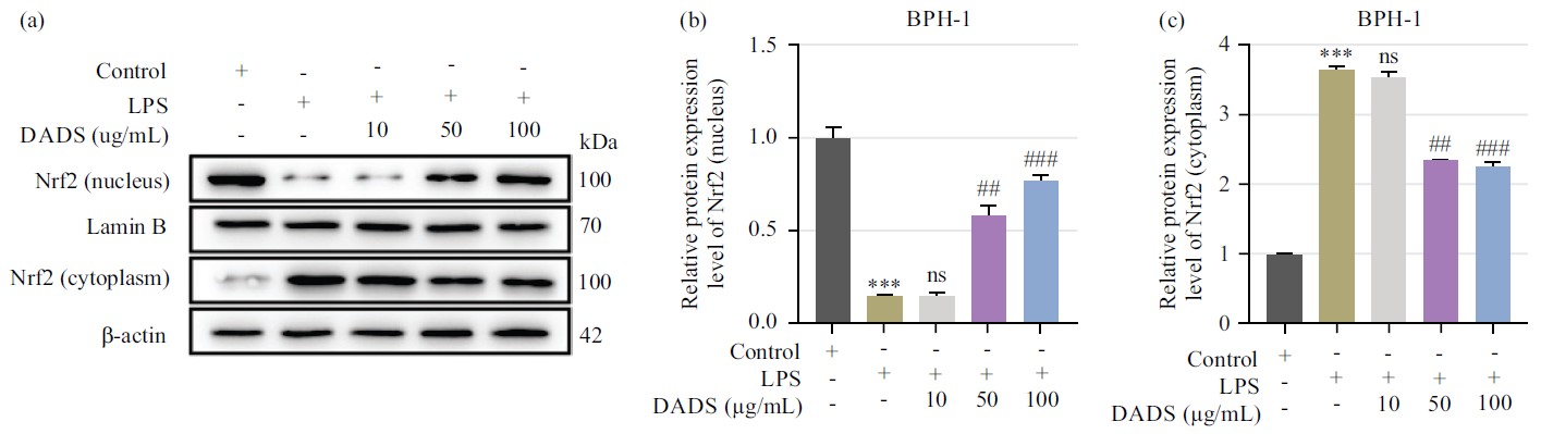 Image for - In vitro Validation of the Therapeutic Potential of Diallyl Disulfide on Benign Prostatic Hyperplasia: Effect on Hyperproliferation, Oxidative Stress and Inflammation