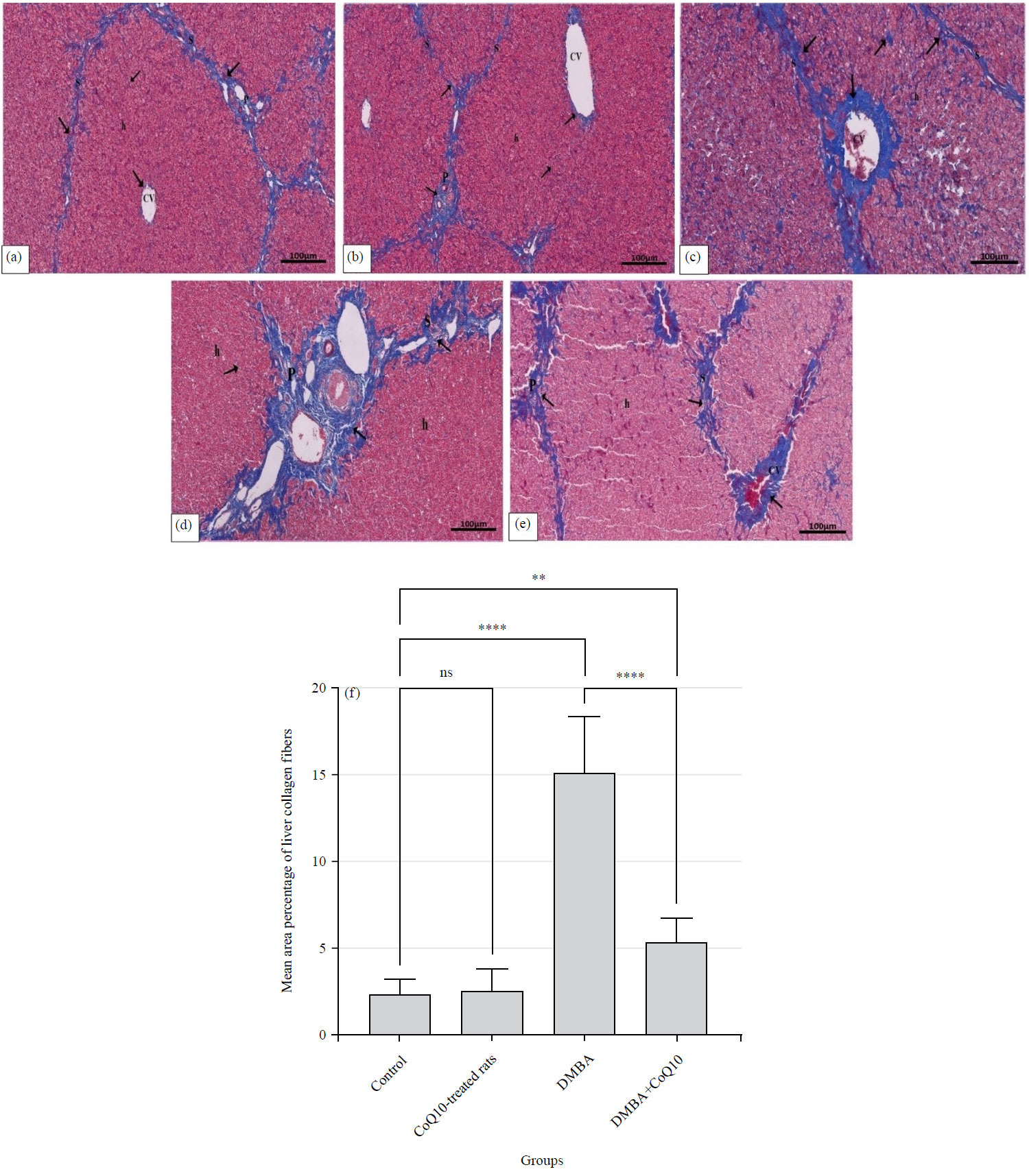 Potential Chemotherapeutic Effect of Coenzyme Q10 Against Liver Injury ...