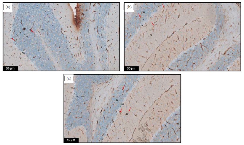 Protective Effects of Luteolin on a Rat Model of Autism: An Analysis of ...