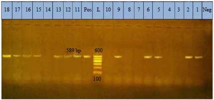 Image for - Molecular Characterization and Virulence of Campylobacter jejuni Isolated from Broiler Chickens