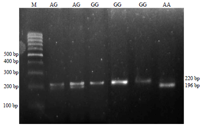 Image for - Association of the Toll-like Receptor 4 (TLR4) and Myxovirus (Mx) Genes With Resistance to Salmonella and Newcastle Disease in Selected Sentul Chickens
